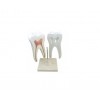 Zęby trzonowe-model